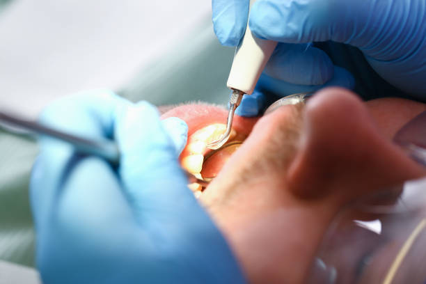 Best Emergency Gum Pain Relief  in Ina, IL